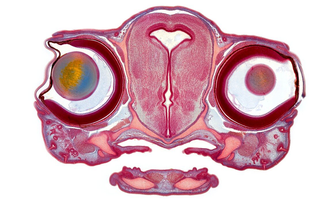 Dogfish head,light micrograph