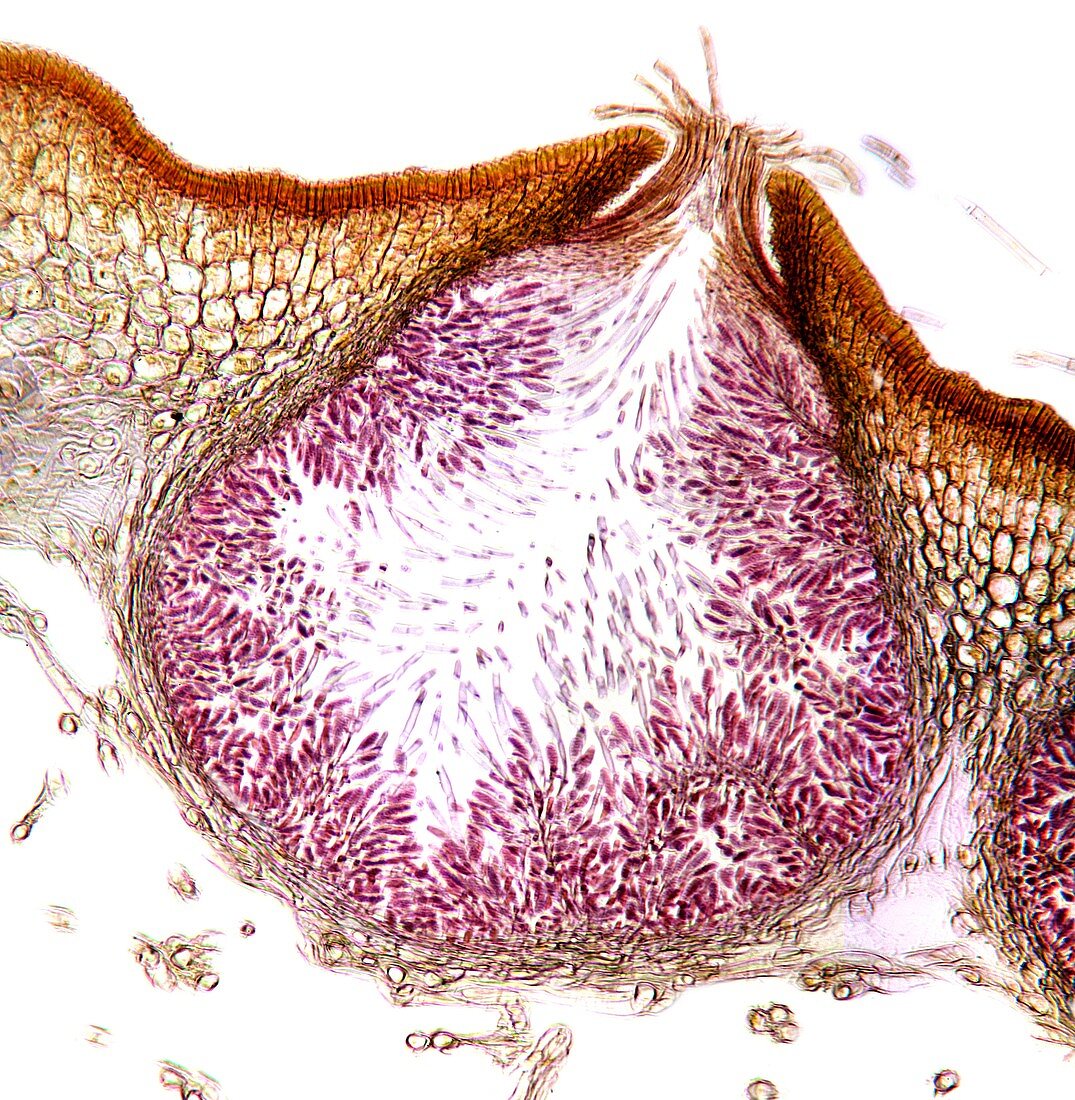 Seaweed male sex organ,micrograph