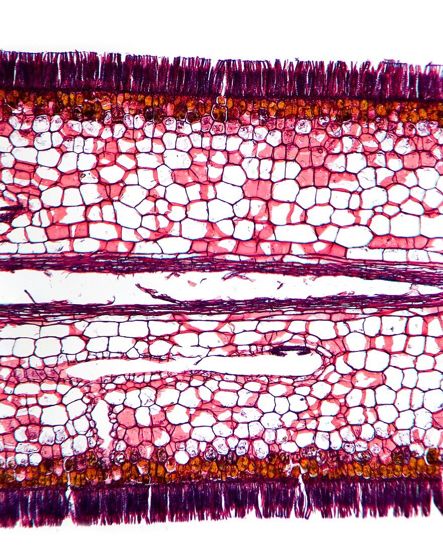 Seaweed sporangia,light micrograph