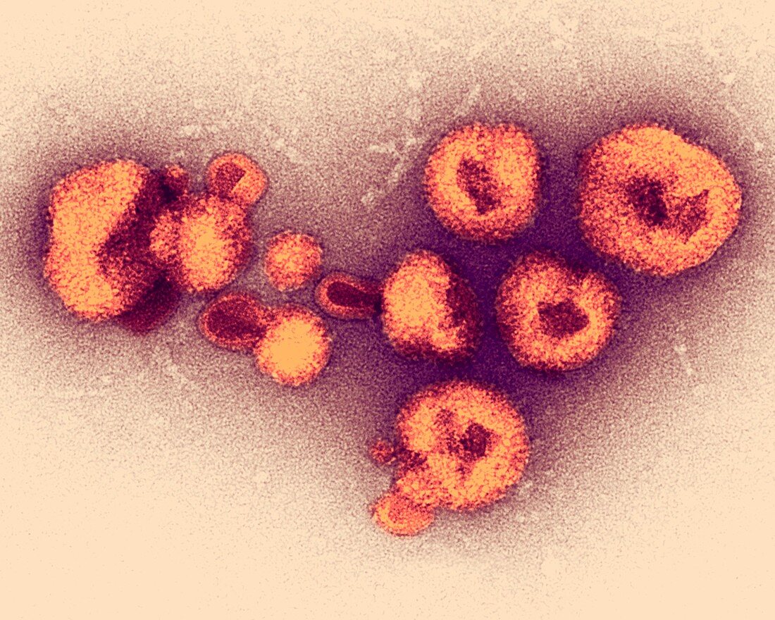 Arenavirus particles,TEM