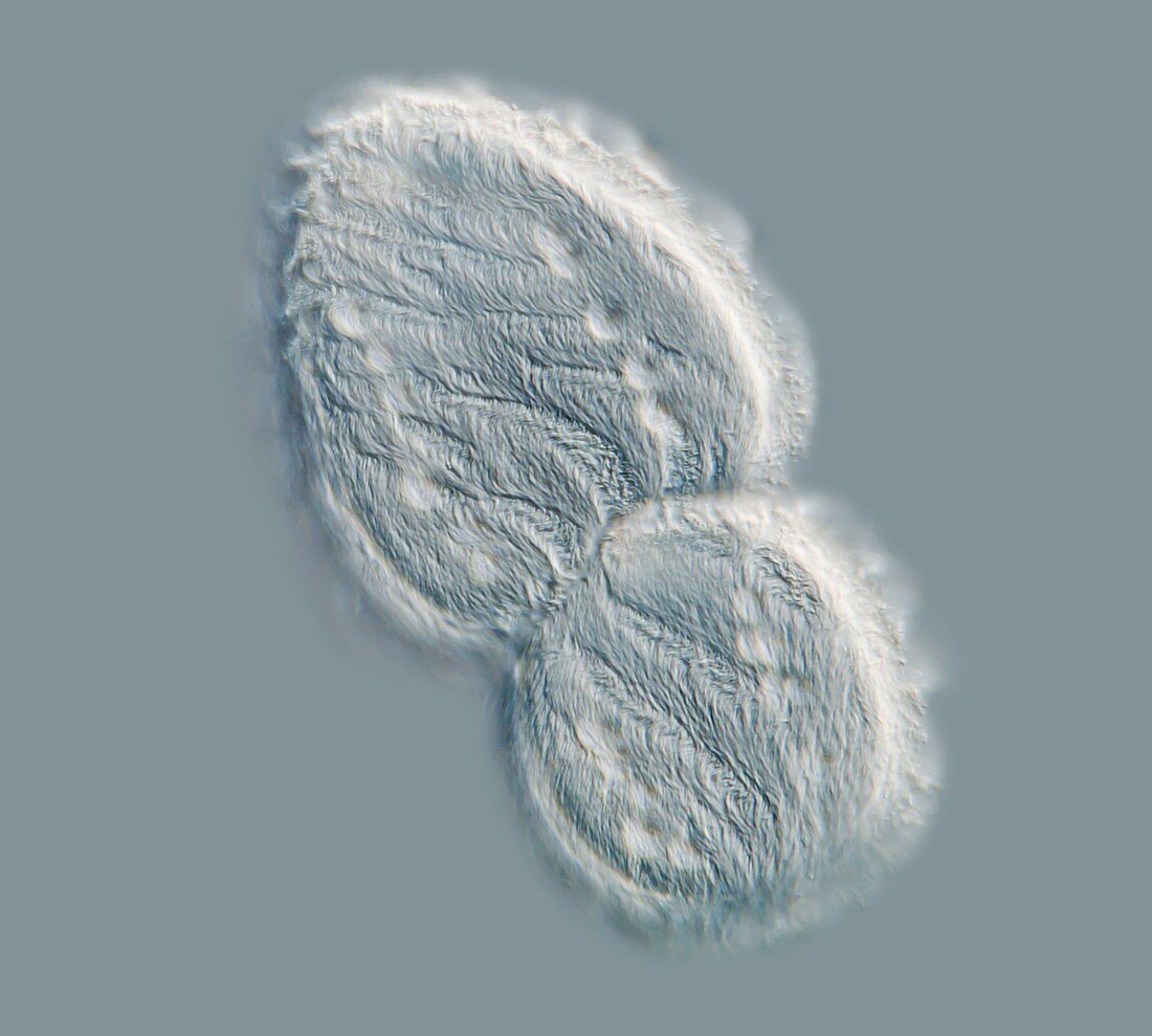 Parasitic protozoan,light micrograph