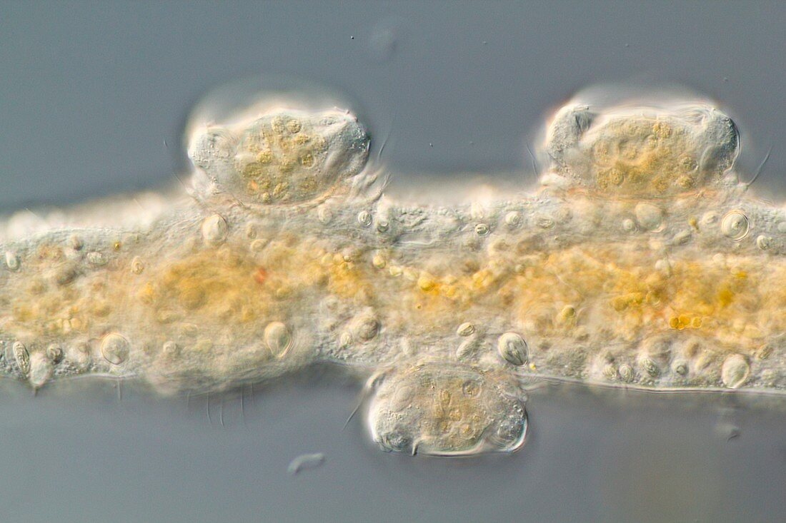 Hypotrich protozoans,light micrograph