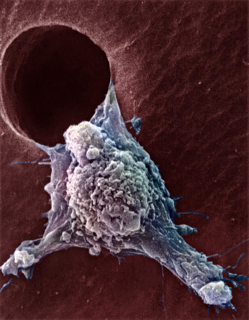 Migrating cancer cell,SEM