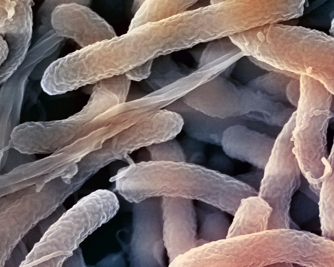 Cholera bacteria,SEM