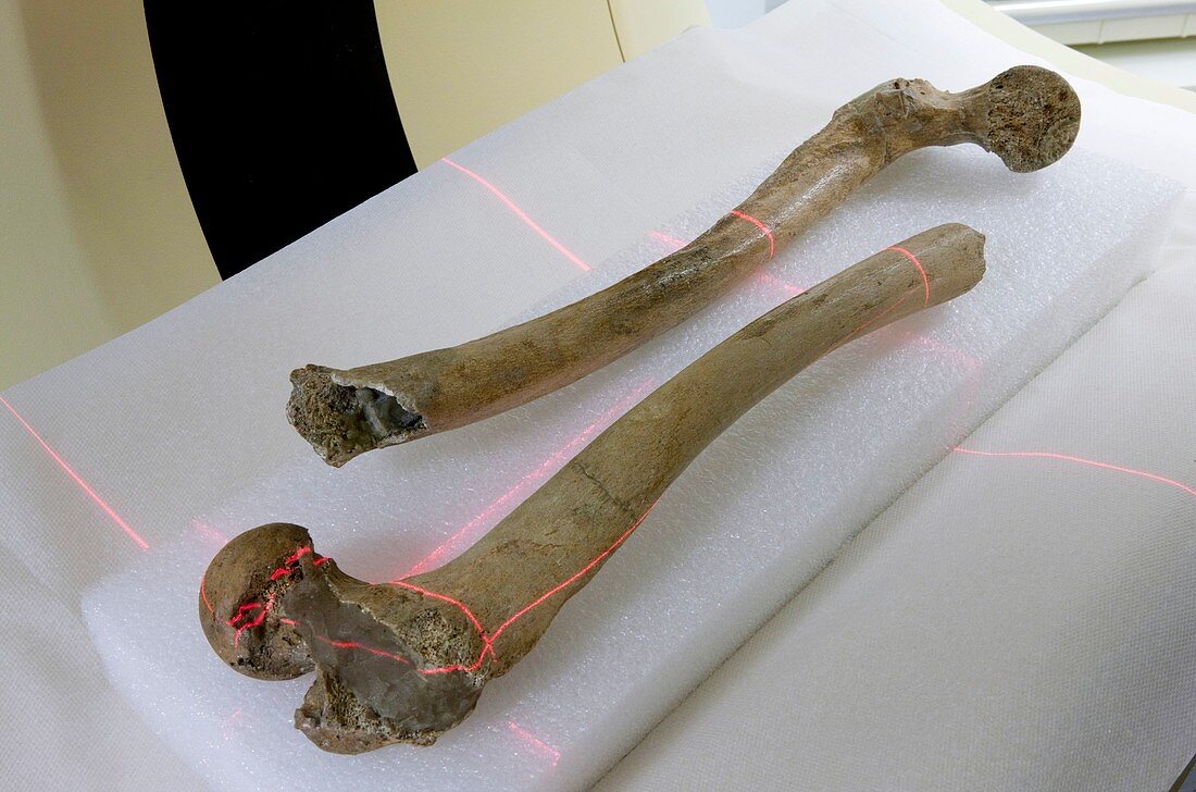 Scanning human fossil thigh bones