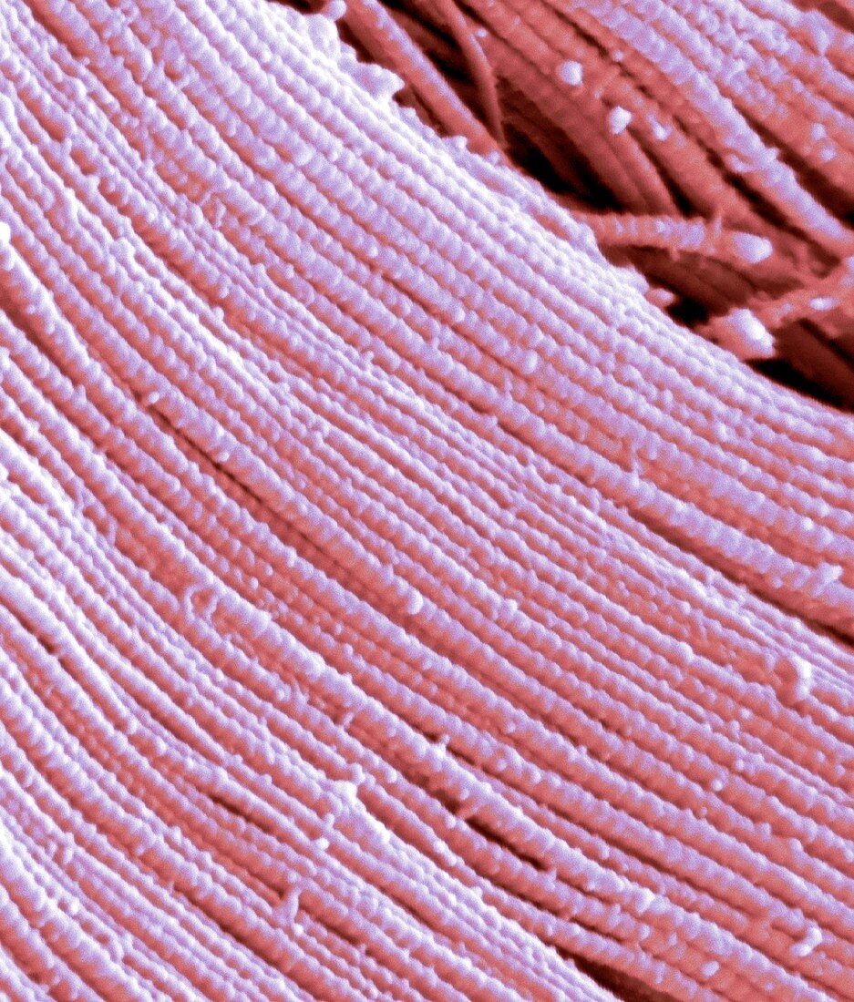 Collagen fibres,SEM