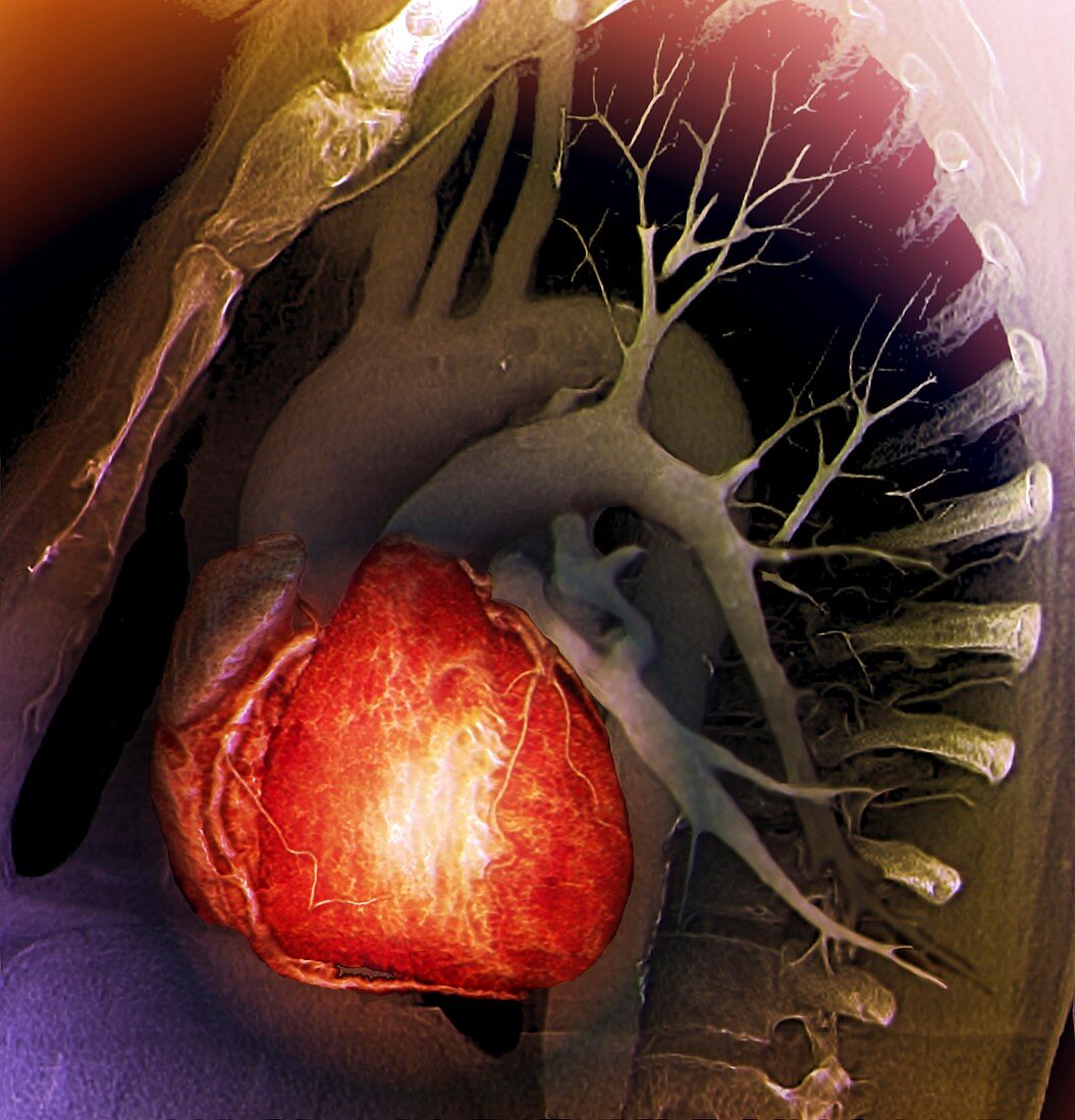 Healthy heart,3D CT scan