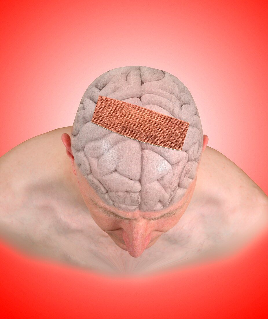 Brain damage,conceptual image