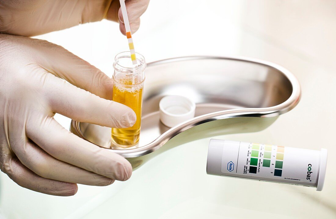 Urine test