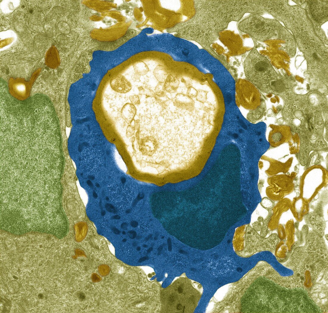 Macrophage engulfing a nerve cell,TEM
