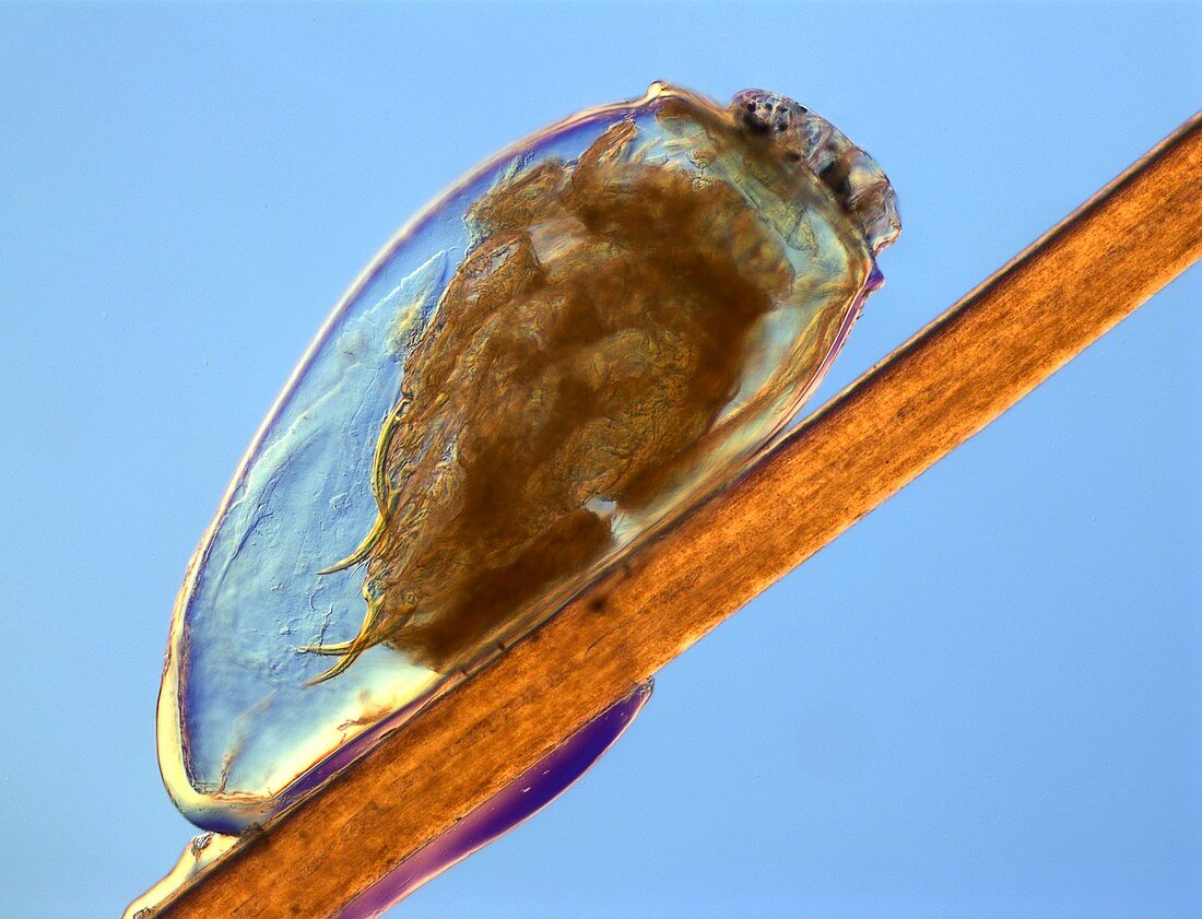 Egg of human head louse pediculus,LM