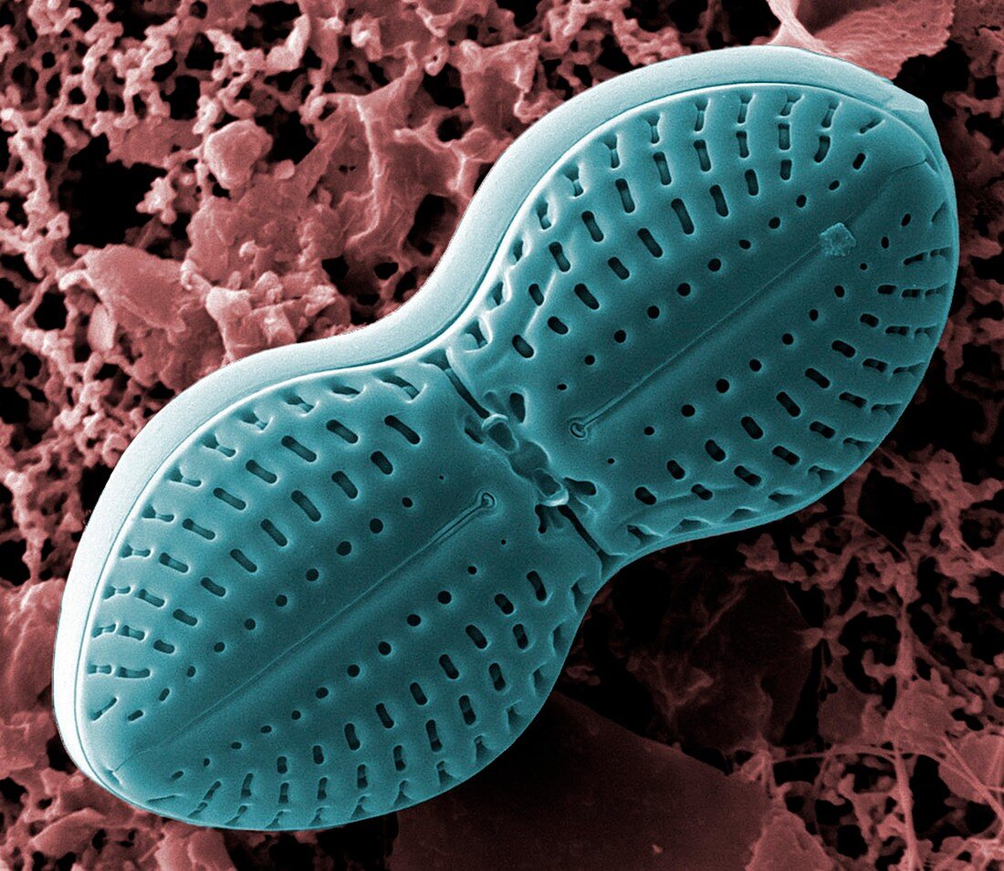 Diploneis diatom,SEM