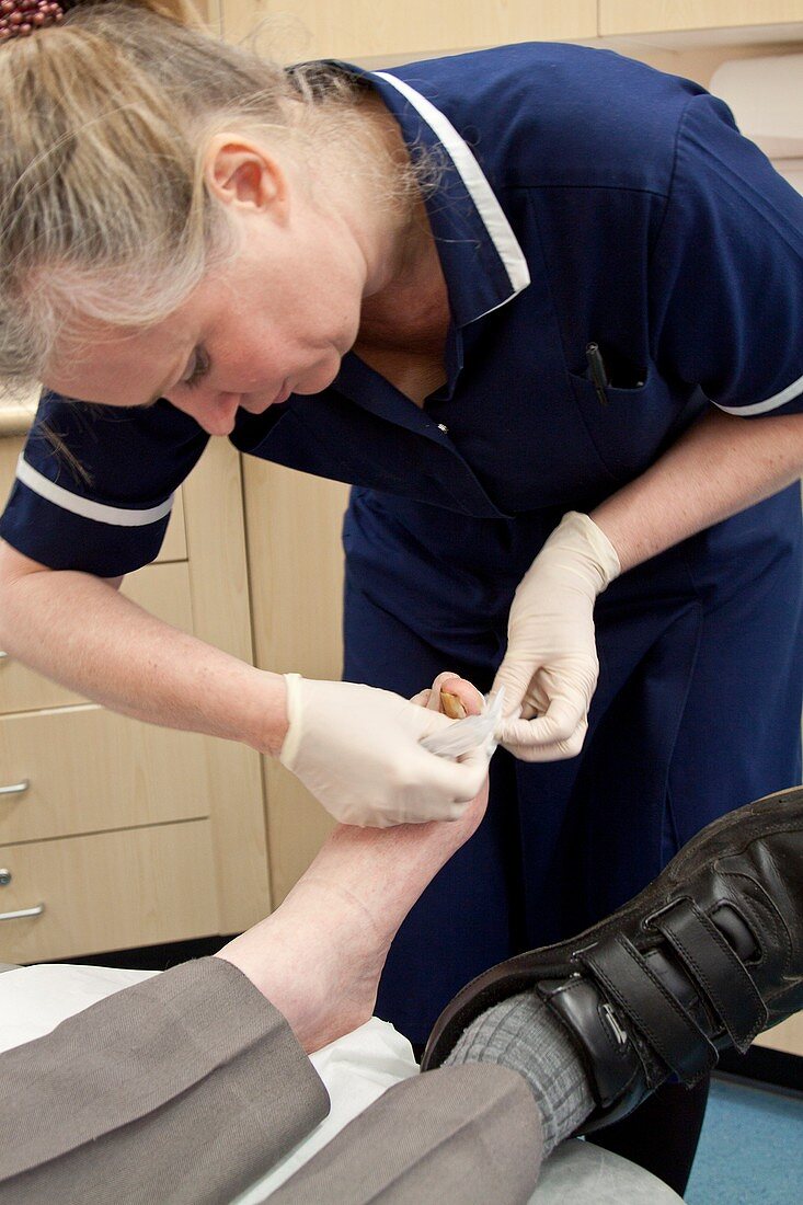 Nurse dressing a patient's toe
