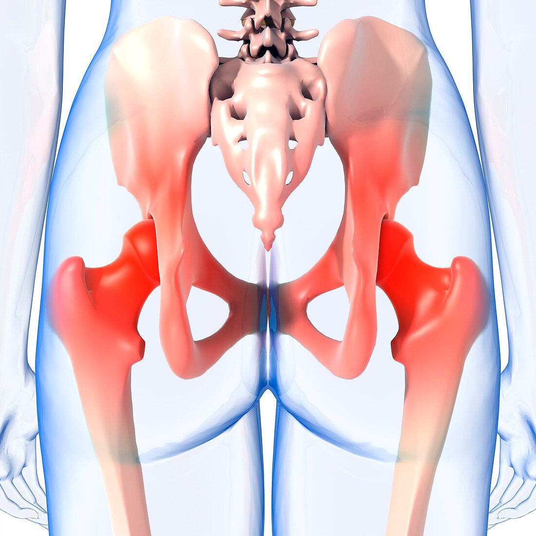 Hip pain,artwork