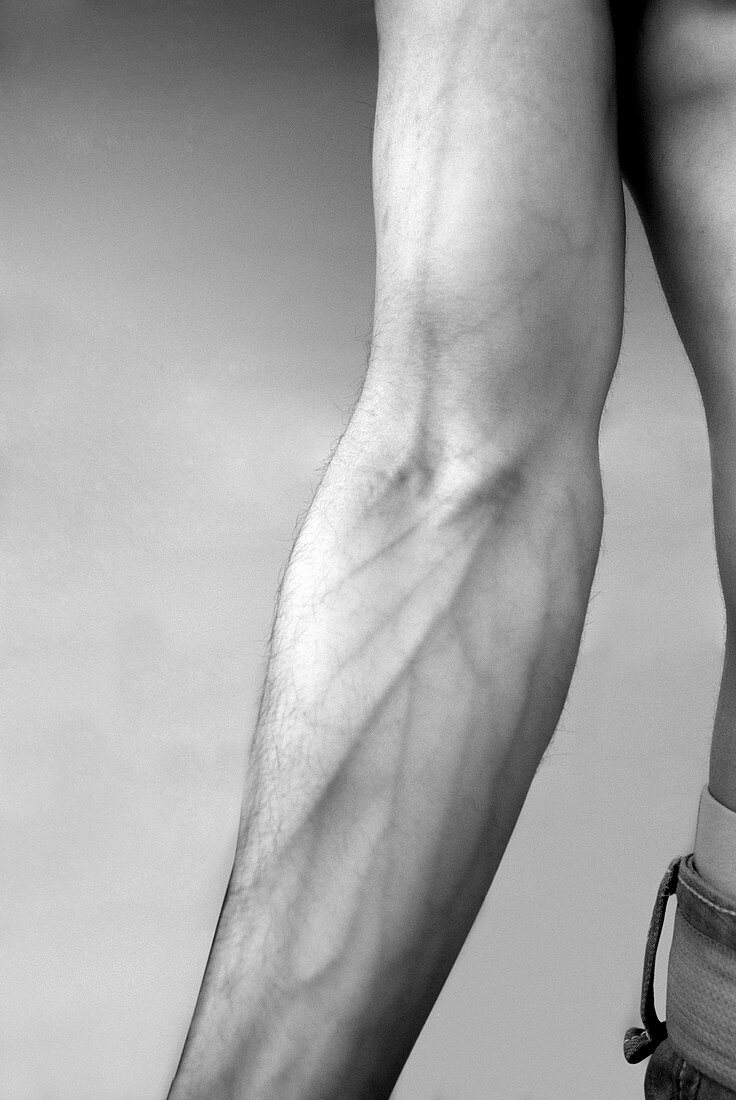 Human arm,infrared image