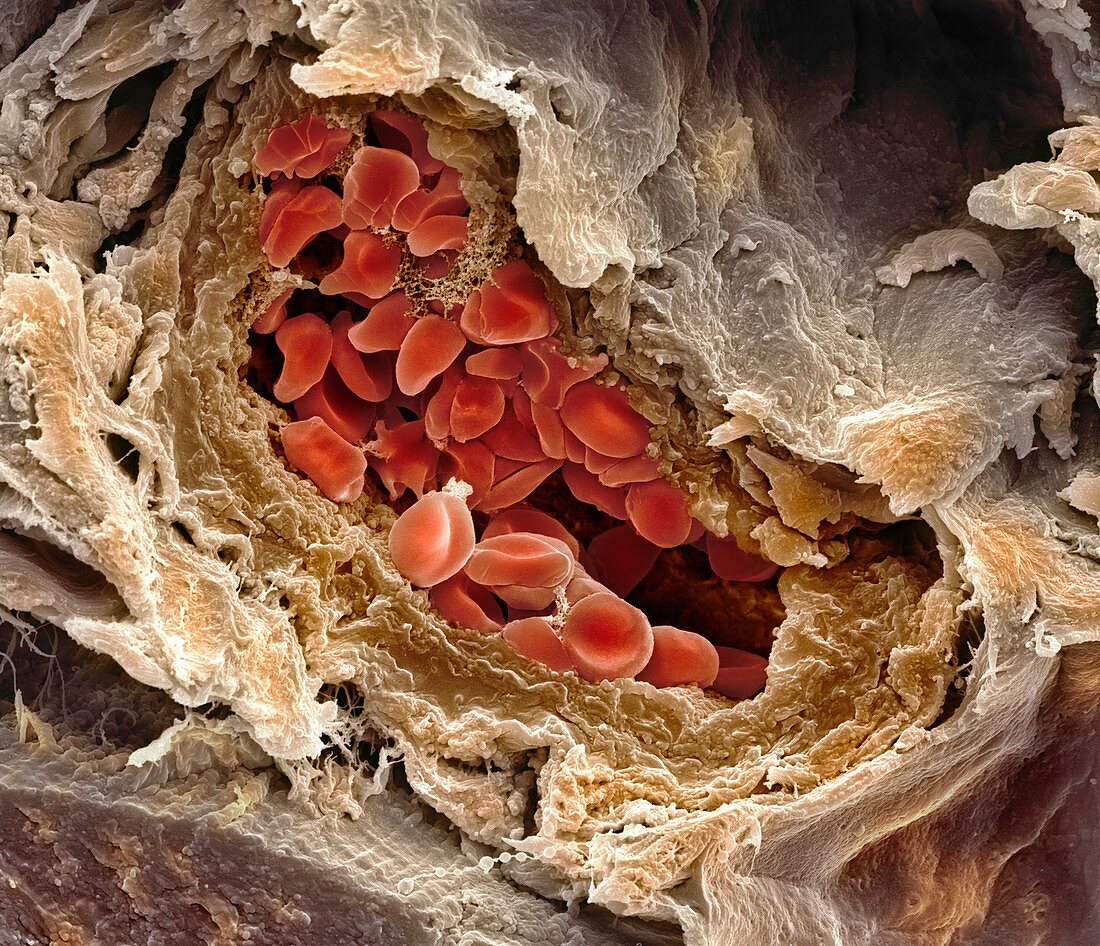 Blood-filled artery,SEM