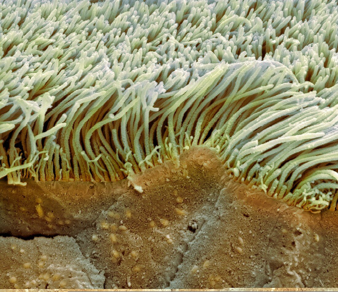 Trachea lining,SEM