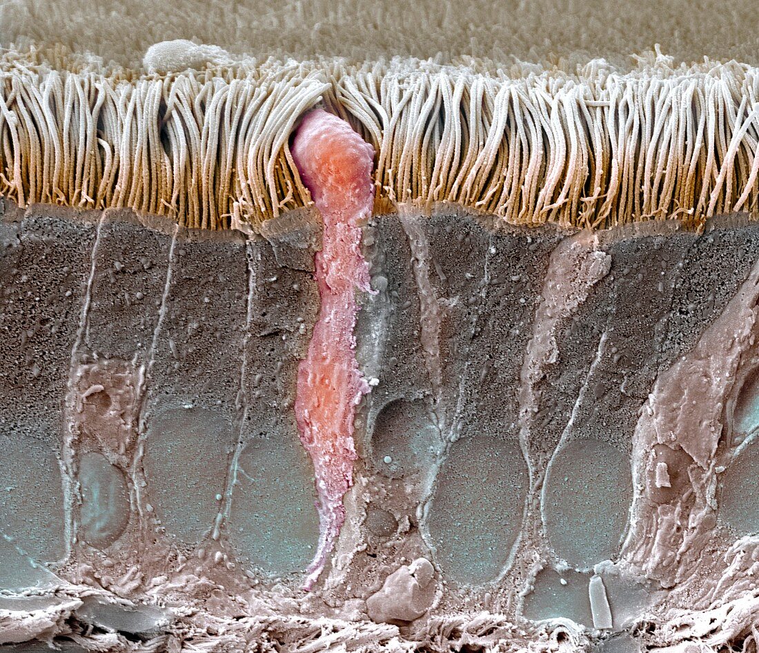 Trachea lining,SEM