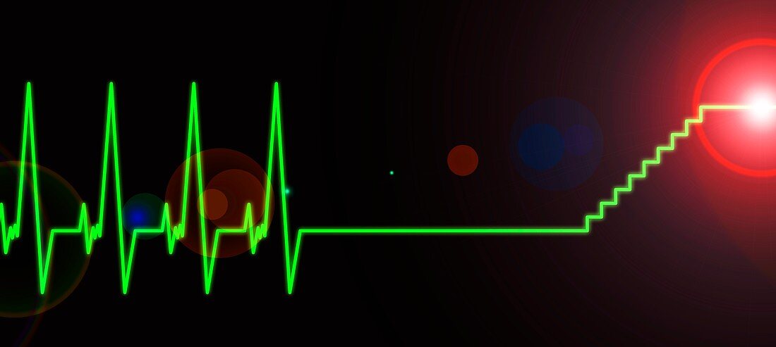 Near-death experience,heartbeat trace
