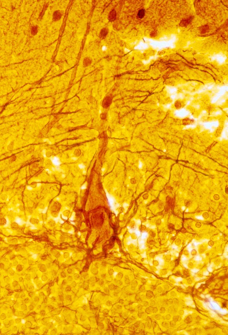 Purkinje nerve cell