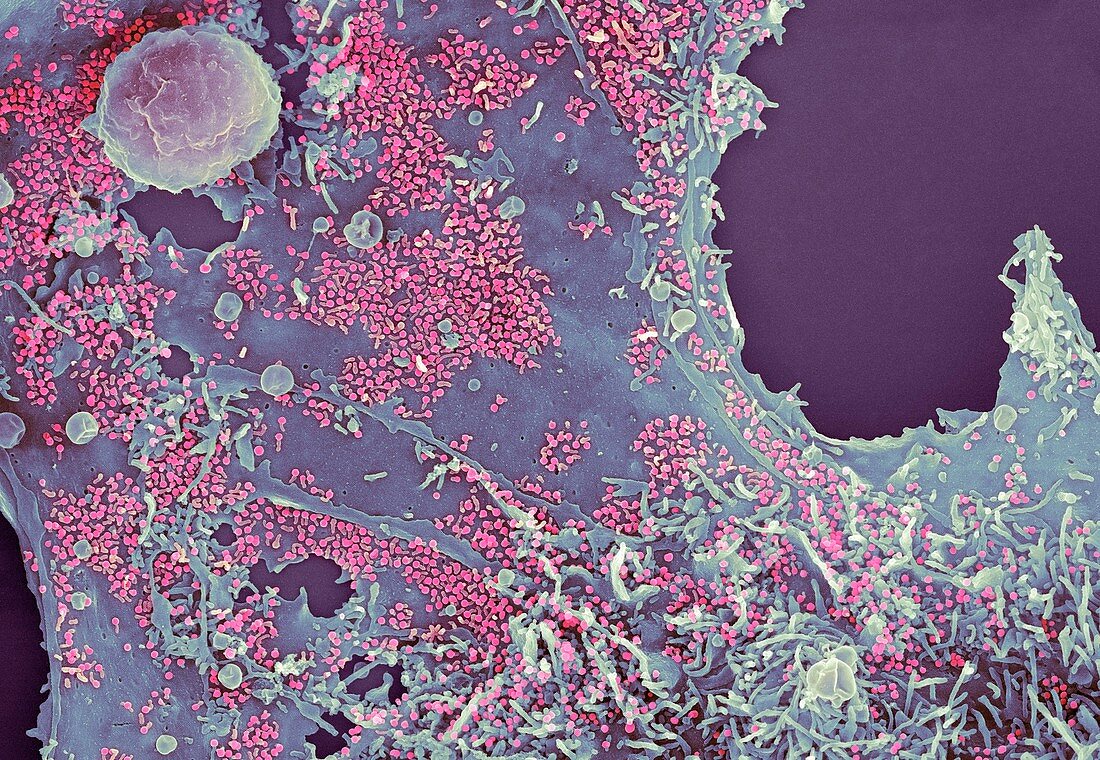 Cell infected with herpes virus,SEM