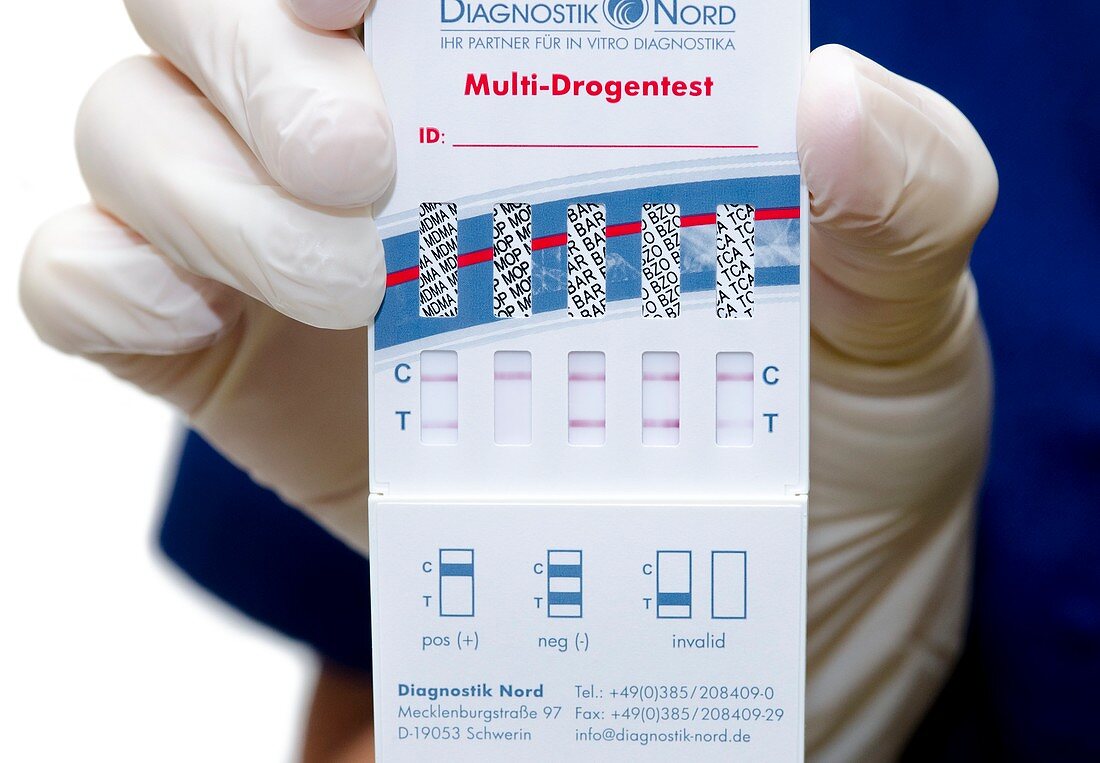 Urine drug test