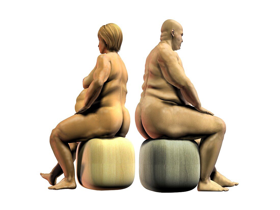 Obesity,artwork