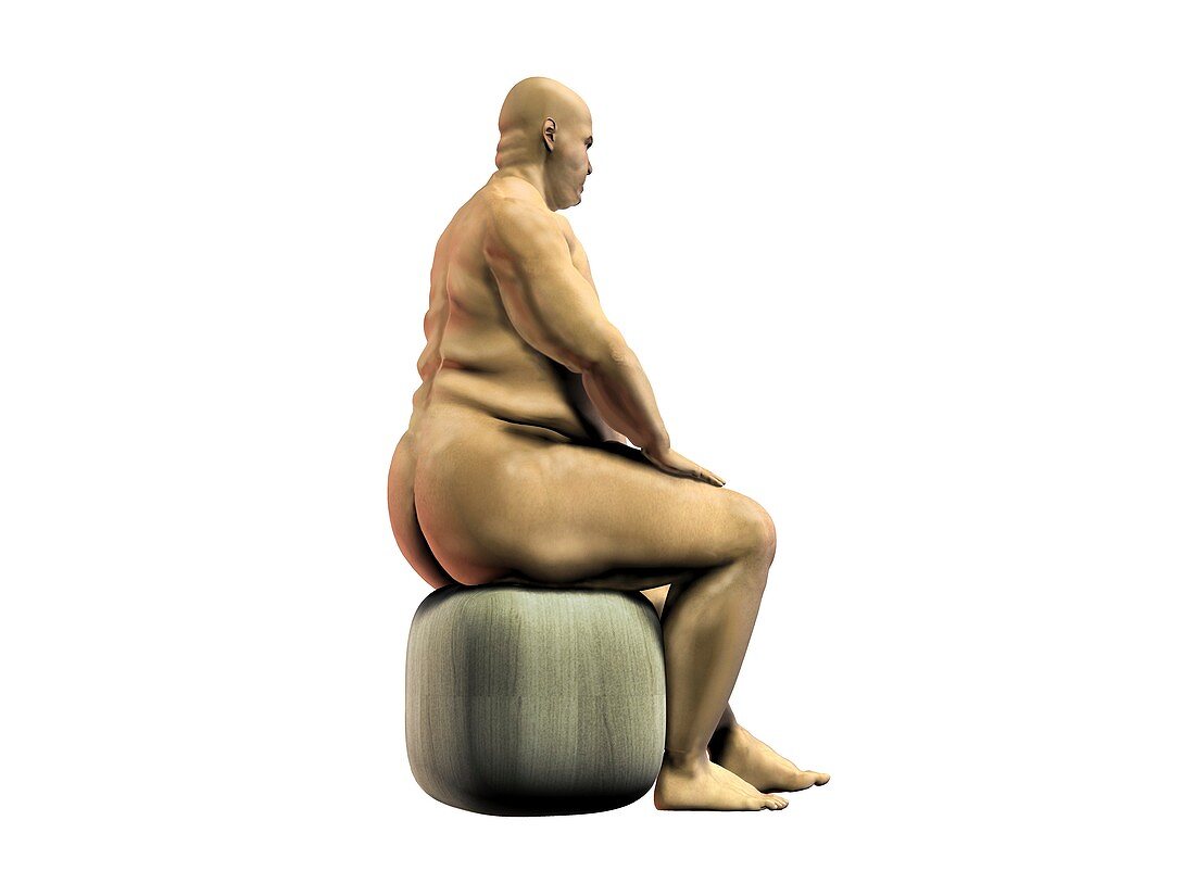 Obese man,artwork