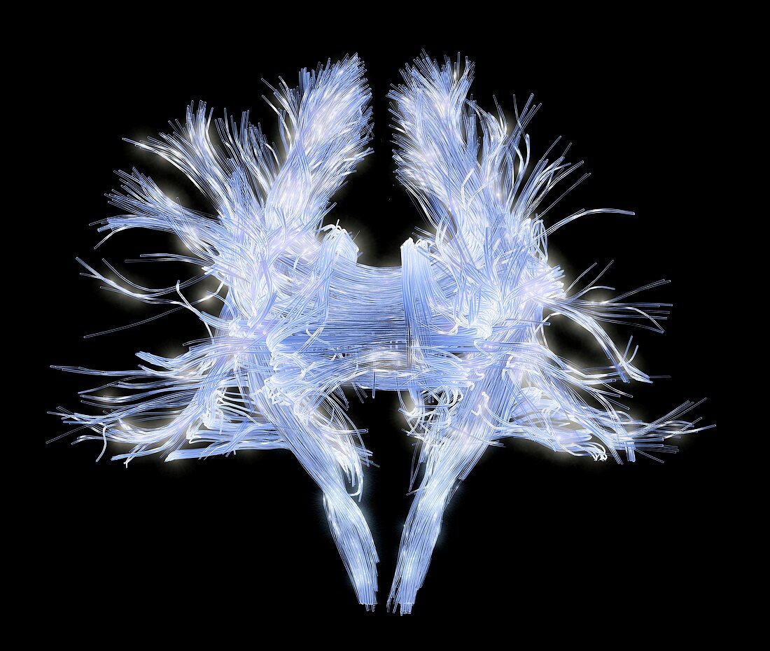 White matter fibres of the human brain