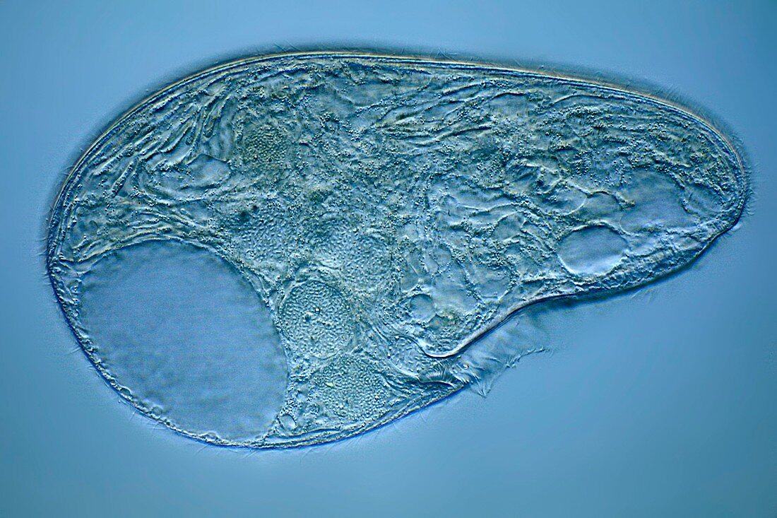 Blepharisma protozoan,light micrograph