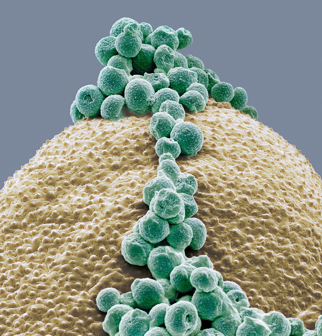 Fungal spores on pollen grain,SEM