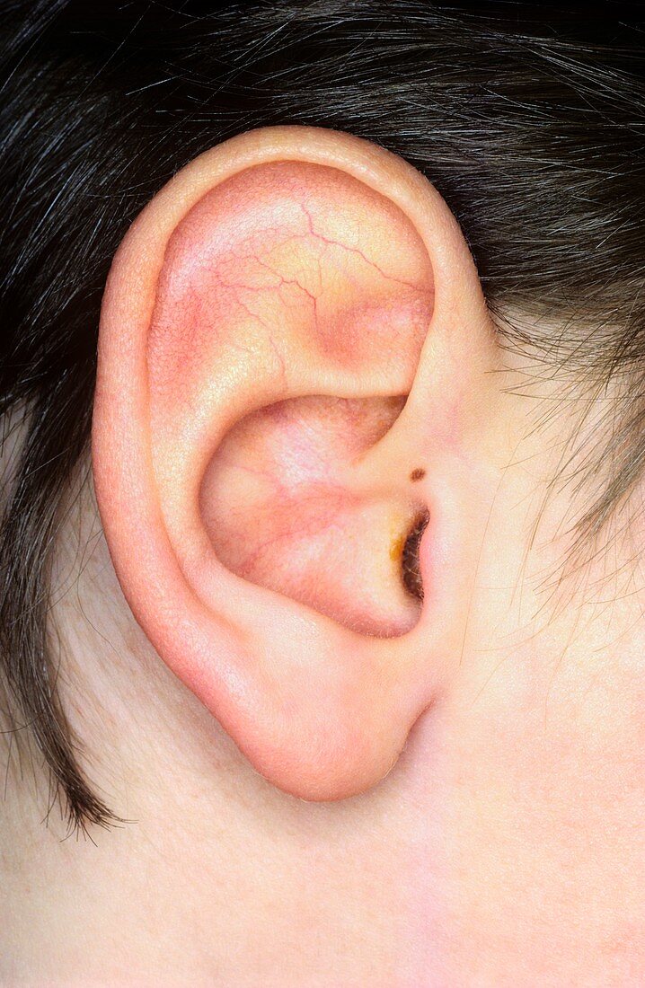 Young boy's ear