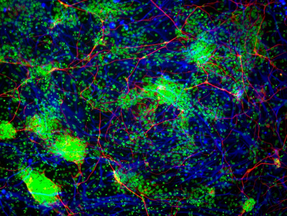 Stem cell-derived nerve cells