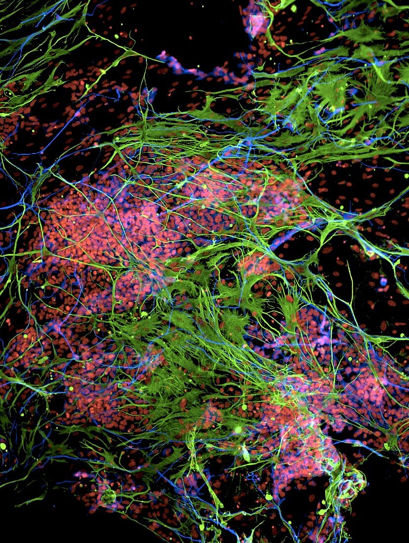 Stem cell-derived nerve cells