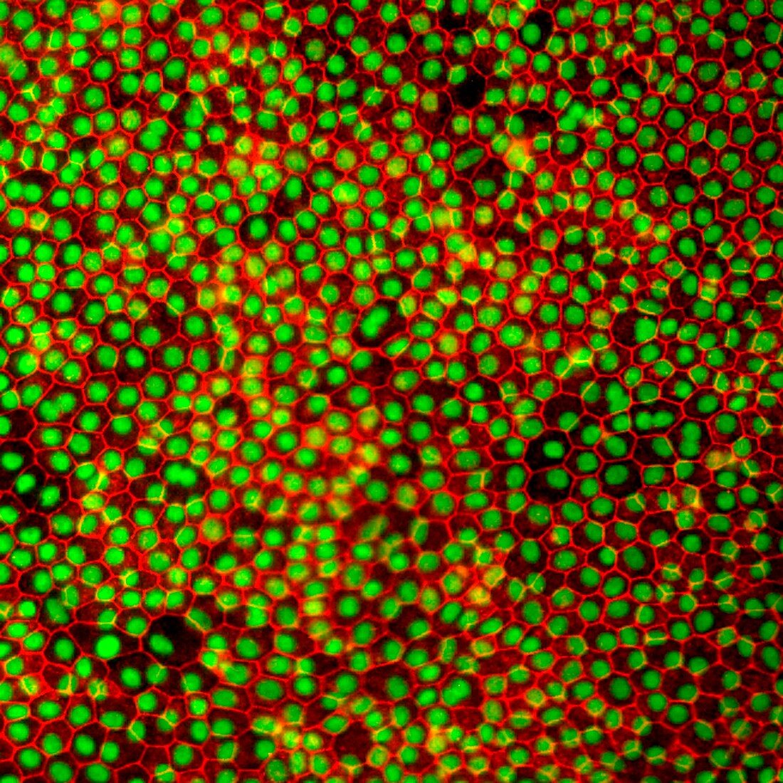 Stem cell-derived retinal cells