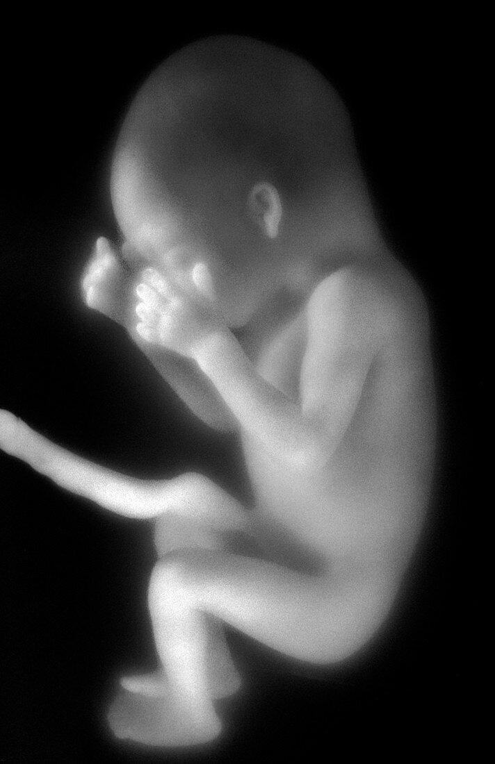 Human foetus in the womb