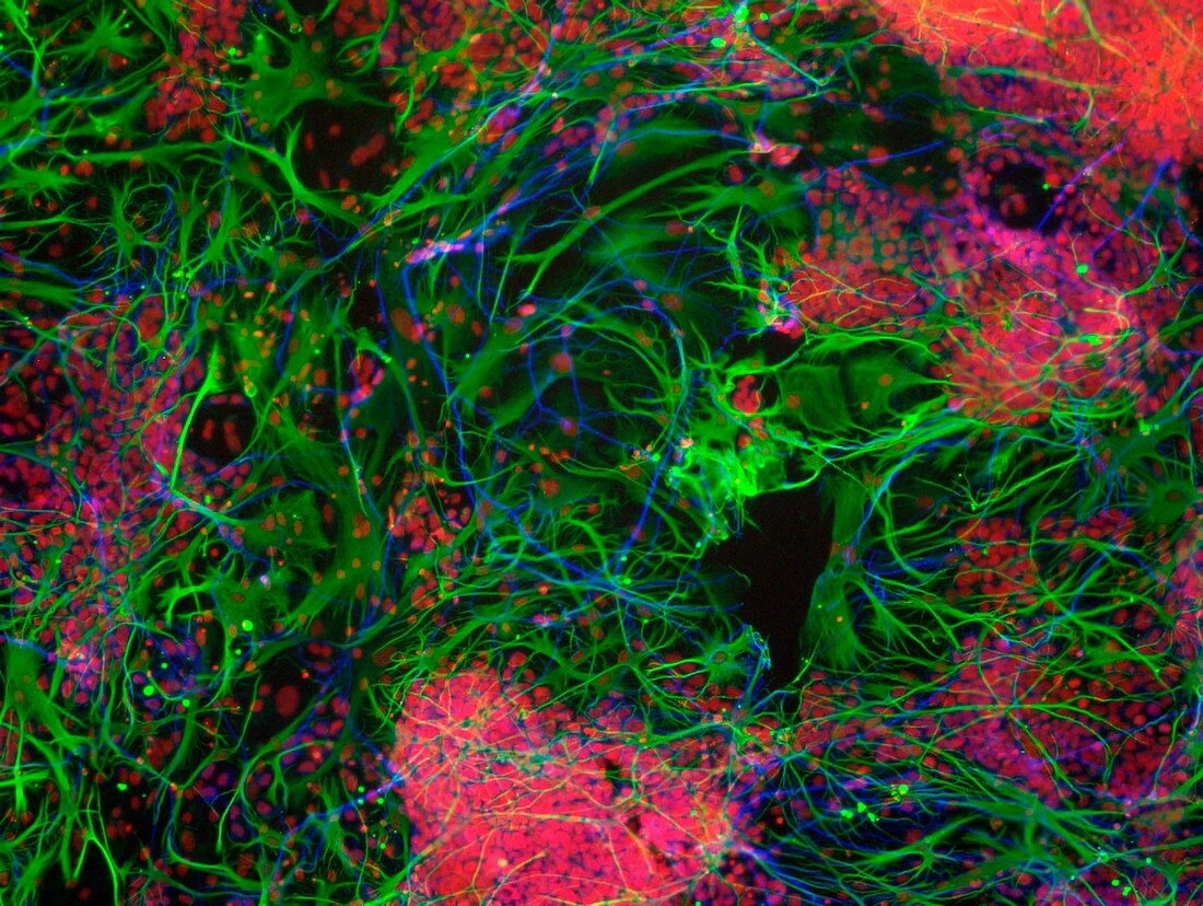 Stem cell-derived nerve cells