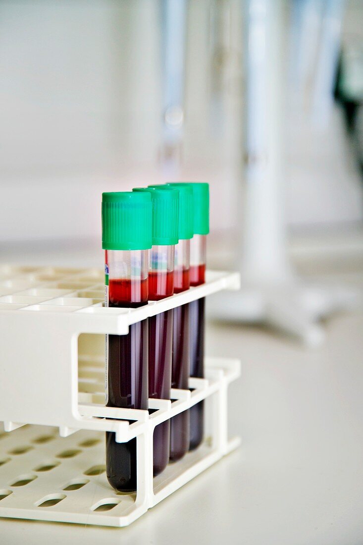 Blood specimens