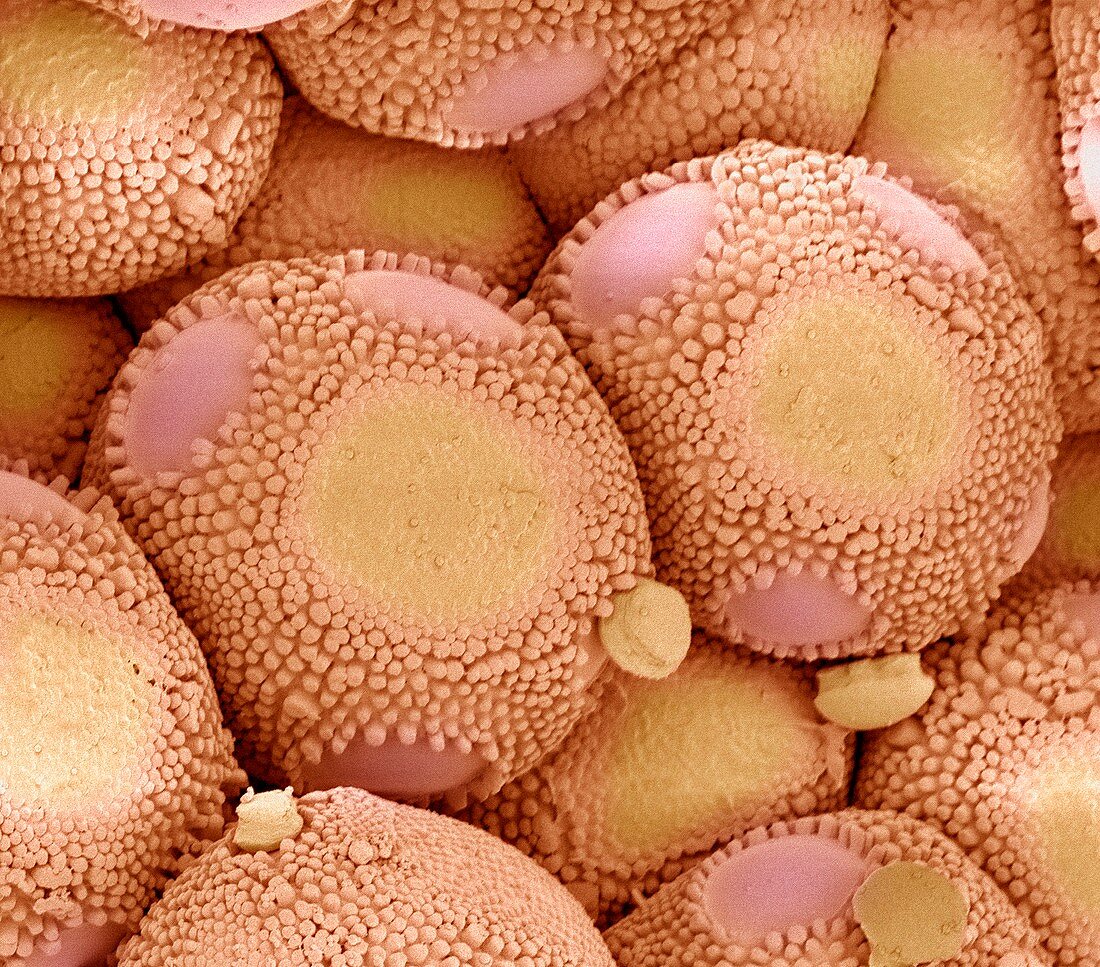 Rust fungus infection,SEM