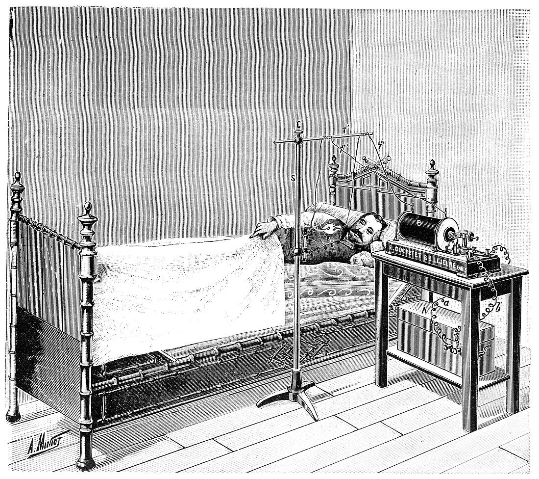 Treatment using X-rays,1897