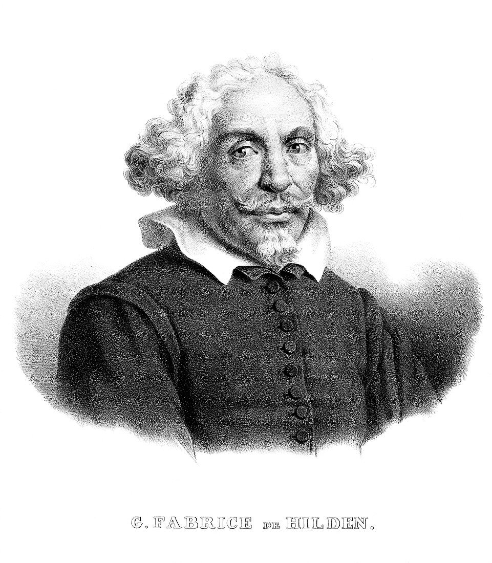 Wilhelm Fabry,German surgeon