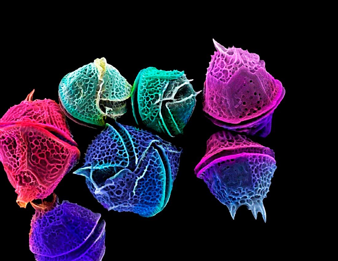 Diatoms,SEM