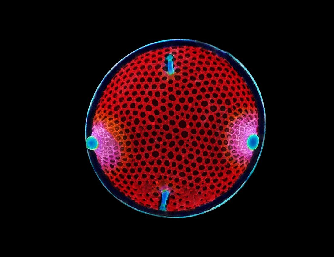 Diatom,SEM