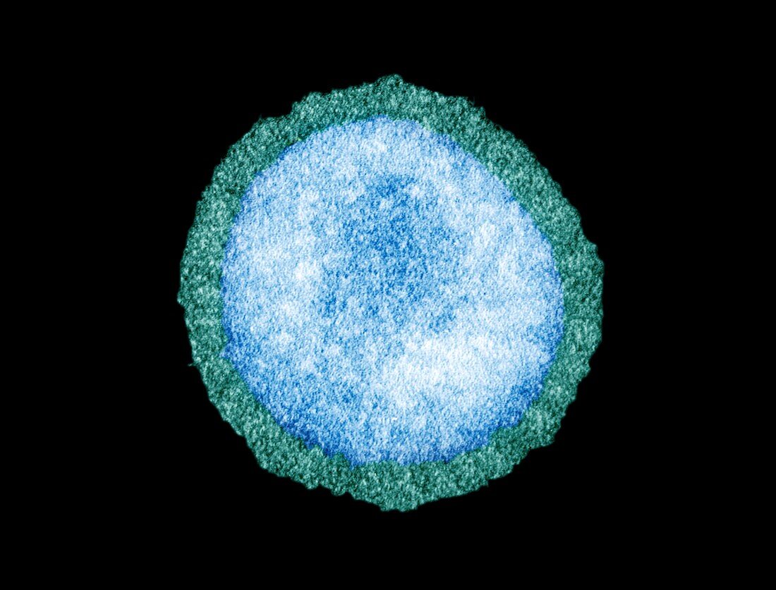 Influenza virus particle,TEM