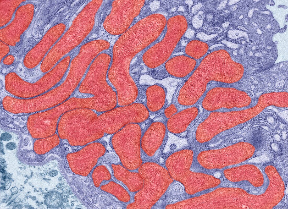 Kidney mitochondria,TEM