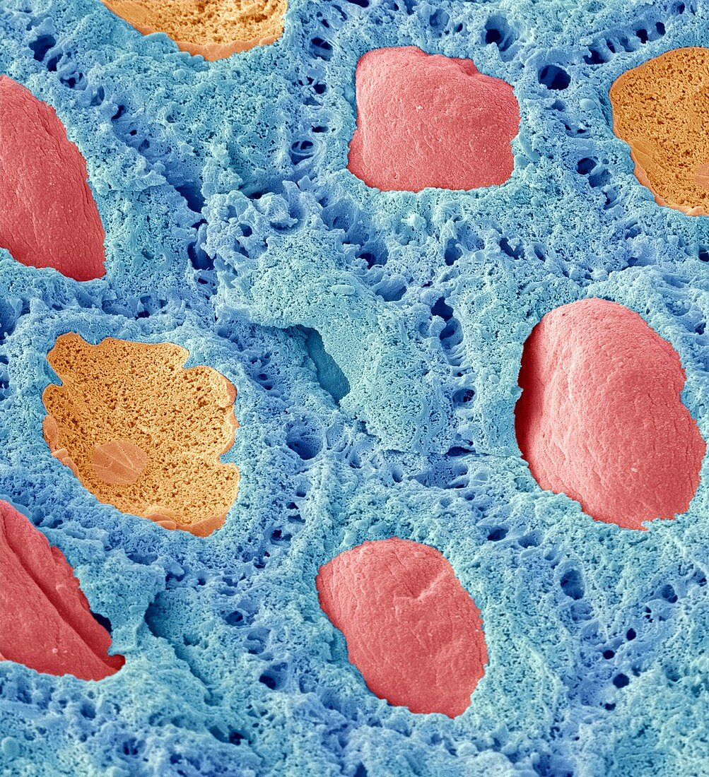 Keratinocyte skin cells,SEM