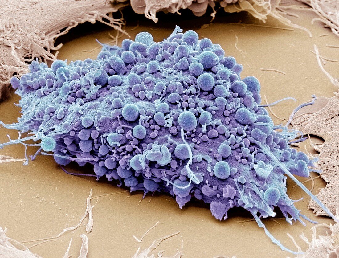 Mesenchymal stem cell,SEM
