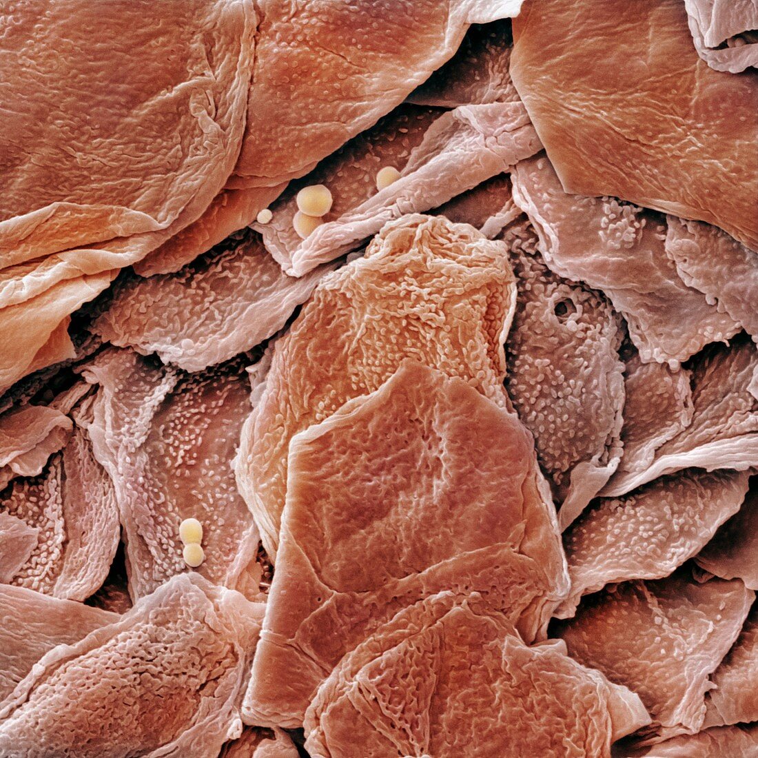 Human Skin Cells (SEM)