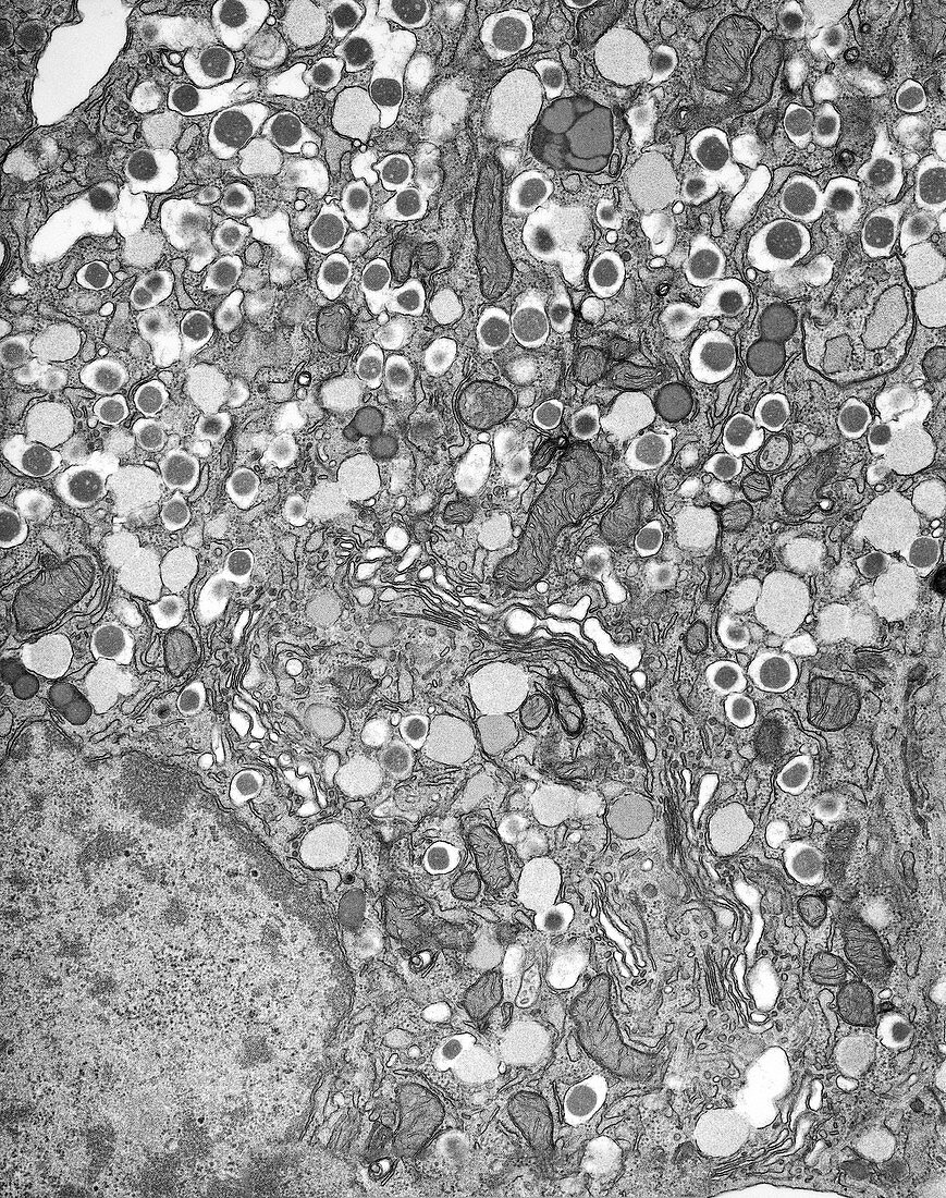 Islet of Langerhans beta cell,TEM