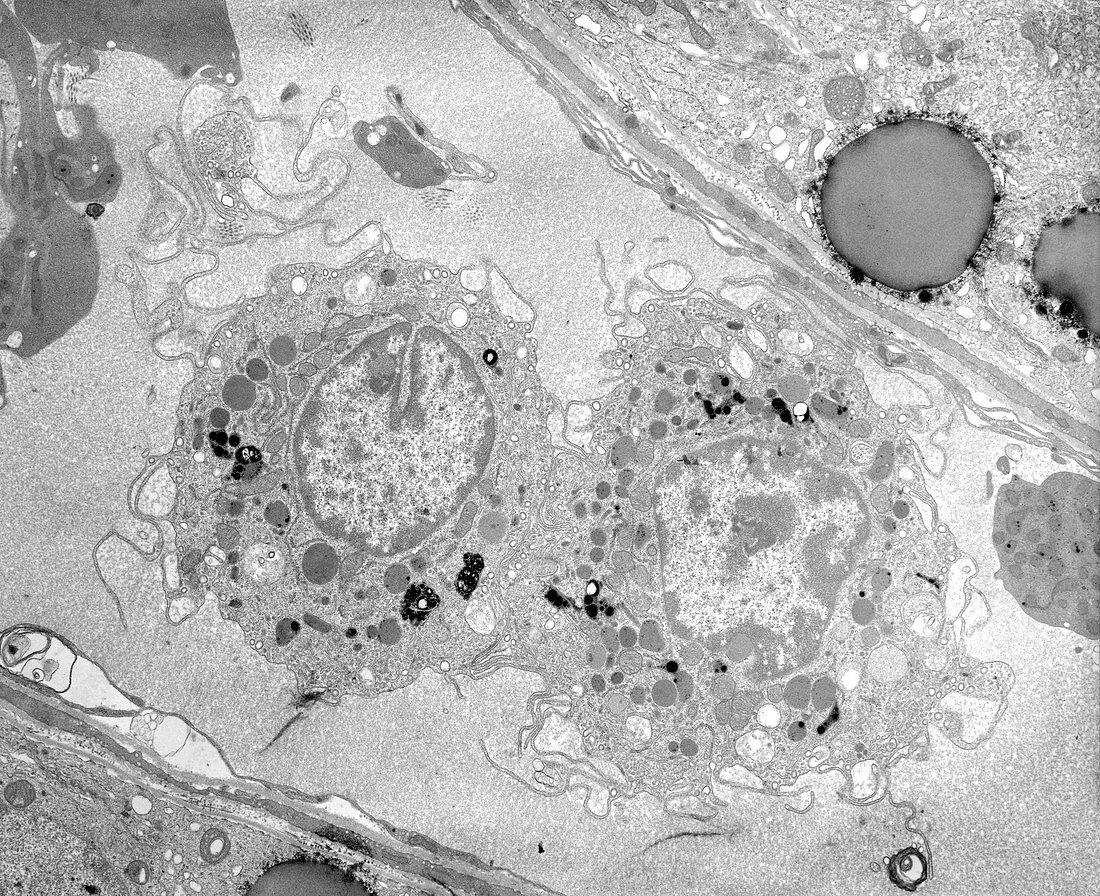 Macrophage white blood cells,TEM